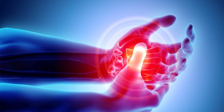 Common Types of Pain Treated with Physiotherapy 