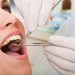 Common General Dentistry Procedures And Their Benefits