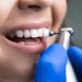 What You Should Know About Dental Exams And Cleanings