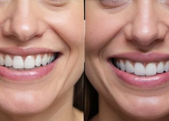 From Check Ups To Smile Makeovers: A Complete Approach To Dental Care