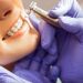 How Orthodontic Treatment Improves Oral Health And Appearance