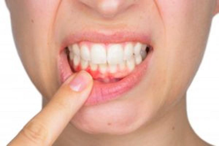 Gum Disease And Tooth Loss: Prevention Through Periodontal Care